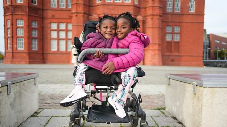 Inseparable Sisters , Senegal, Conjoined Twins
