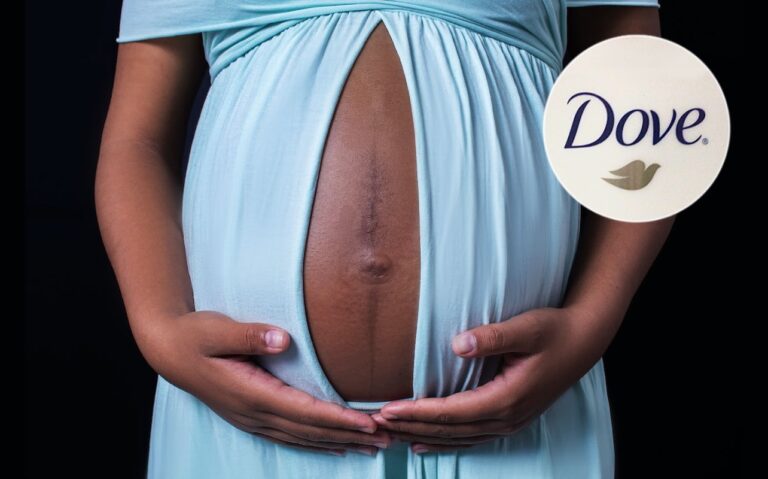 Baby Dove, Black Maternal Health, Expected Care Campaign